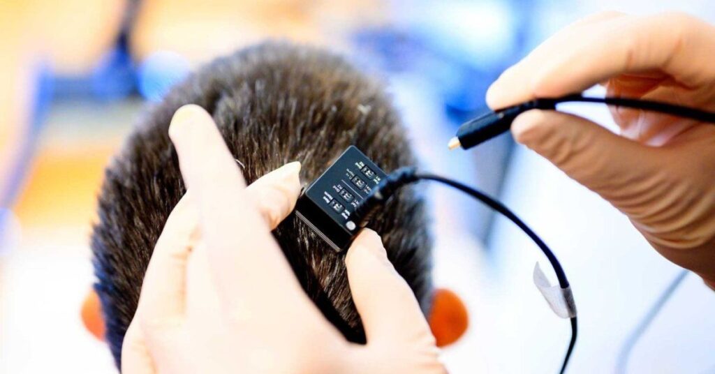 : linguagem para paralisia: IA devolve voz após 18 anos